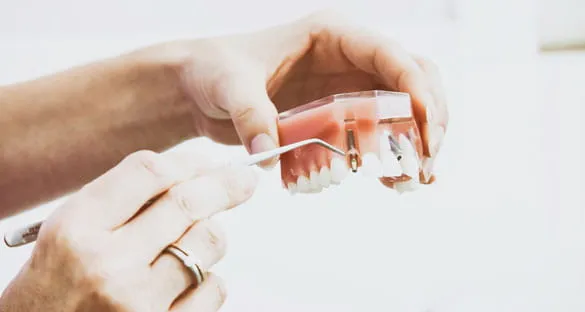 Doctor Explaining Teeth Model