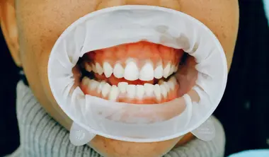 Periodontics